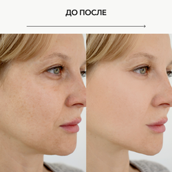 Лимфодренажный криомассажер OK BEAUTY CRYO LIFTING