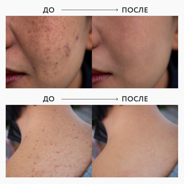 Мультифункциональный пилинг-лосьон OK BEAUTY REFINE & PEEL