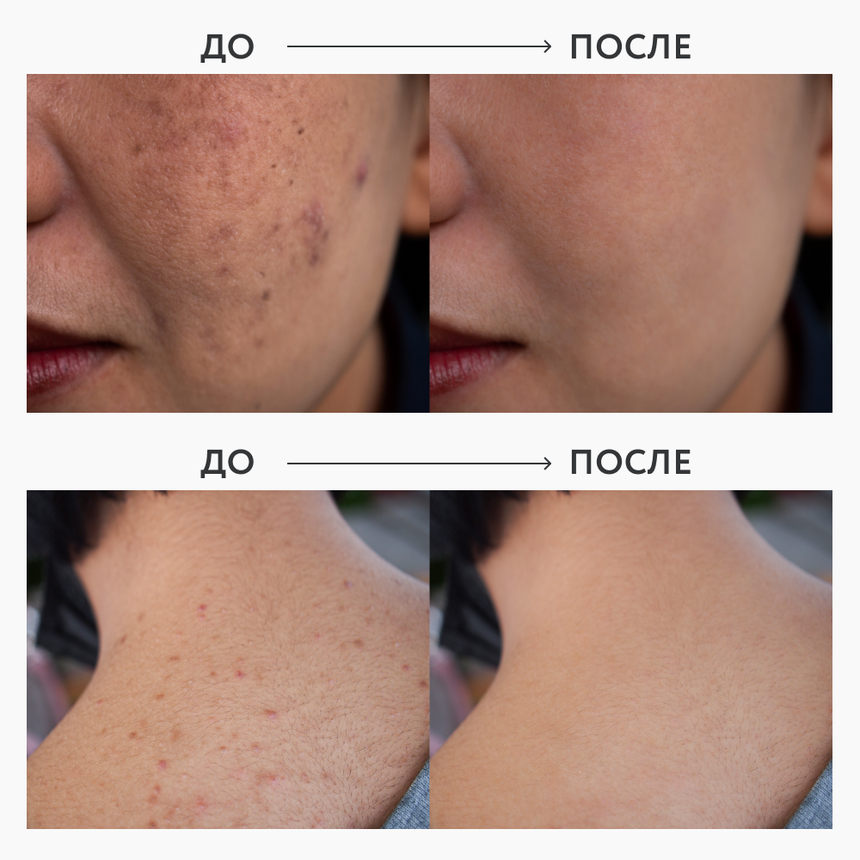 Мультифункциональный пилинг-лосьон OK BEAUTY REFINE & PEEL