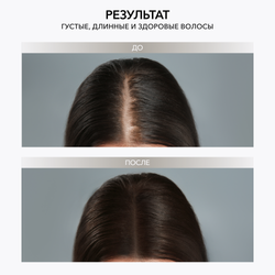 Набор для роста и против выпадения волос OK BEAUTY WAKE UP THERAPY